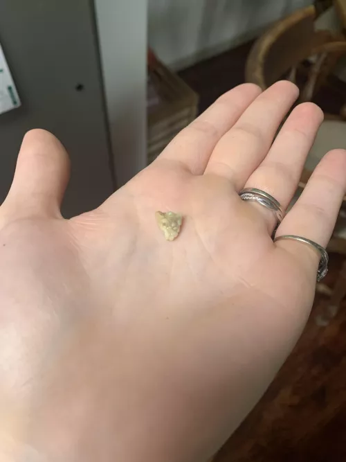 The aliens didn’t build the pyramids…MY TONSILS DID