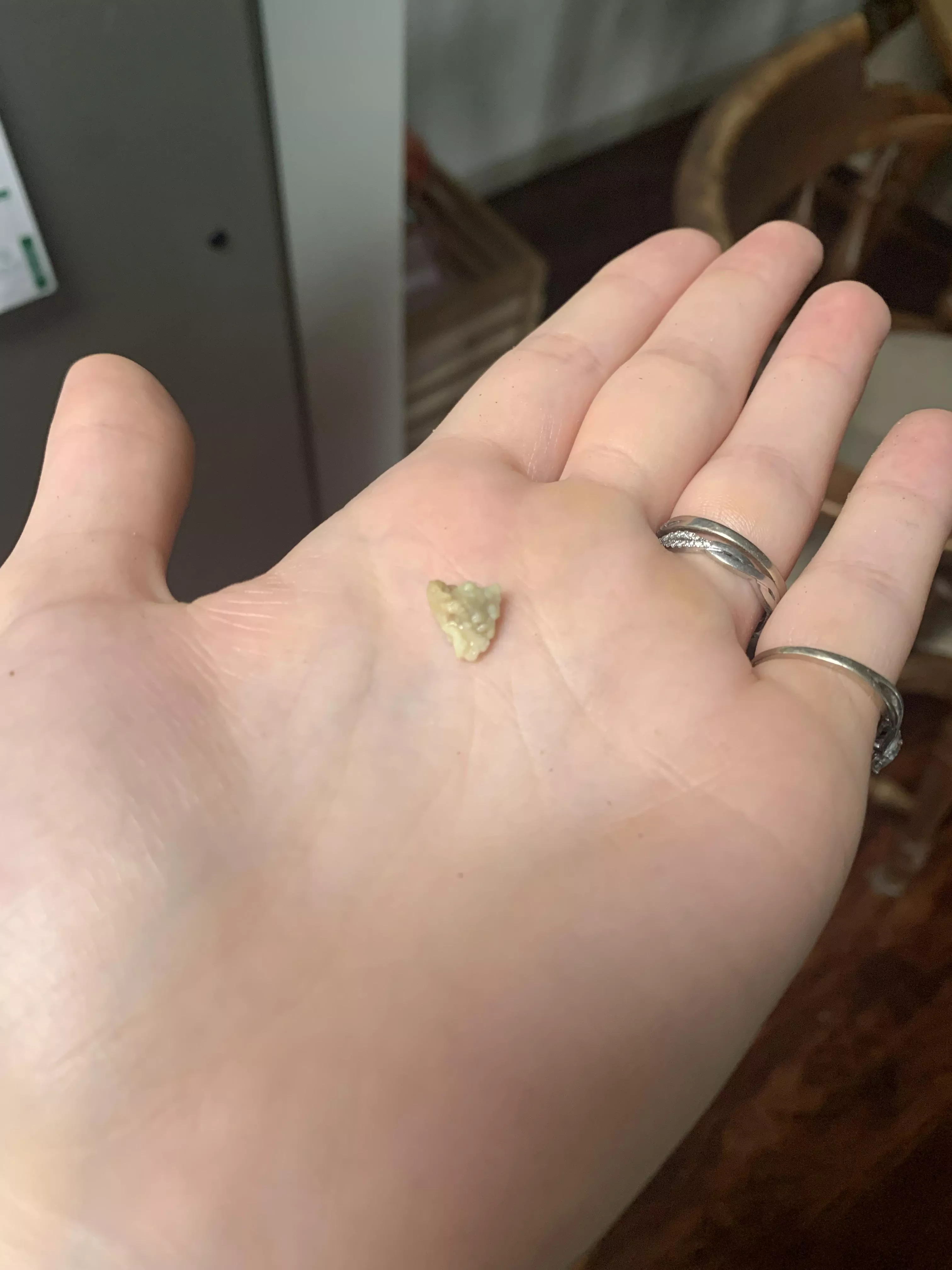 The aliens didn’t build the pyramids…MY TONSILS DID