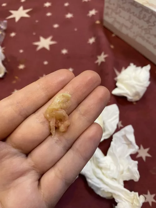 This coming out of my throat and I don’t know what it is, is like chicken flesh
