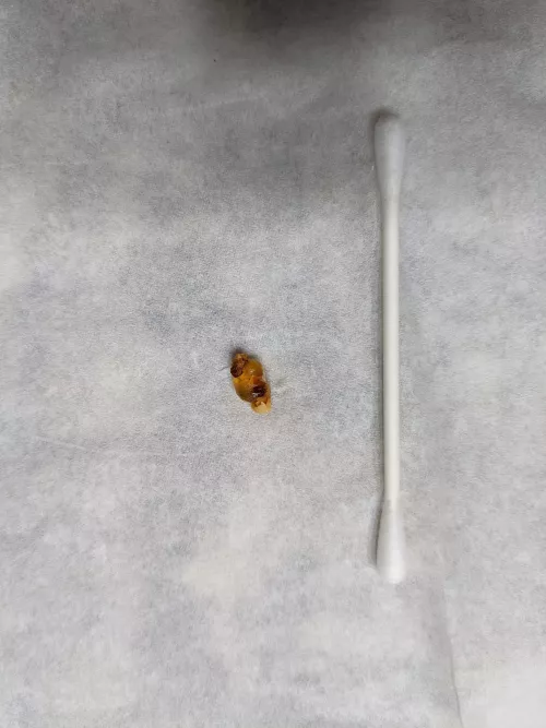 This wax-crusted chunk of what felt like silicone gel we pulled out of my 6YO's ear.