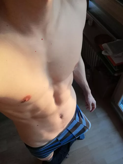 What would you do? 🤔