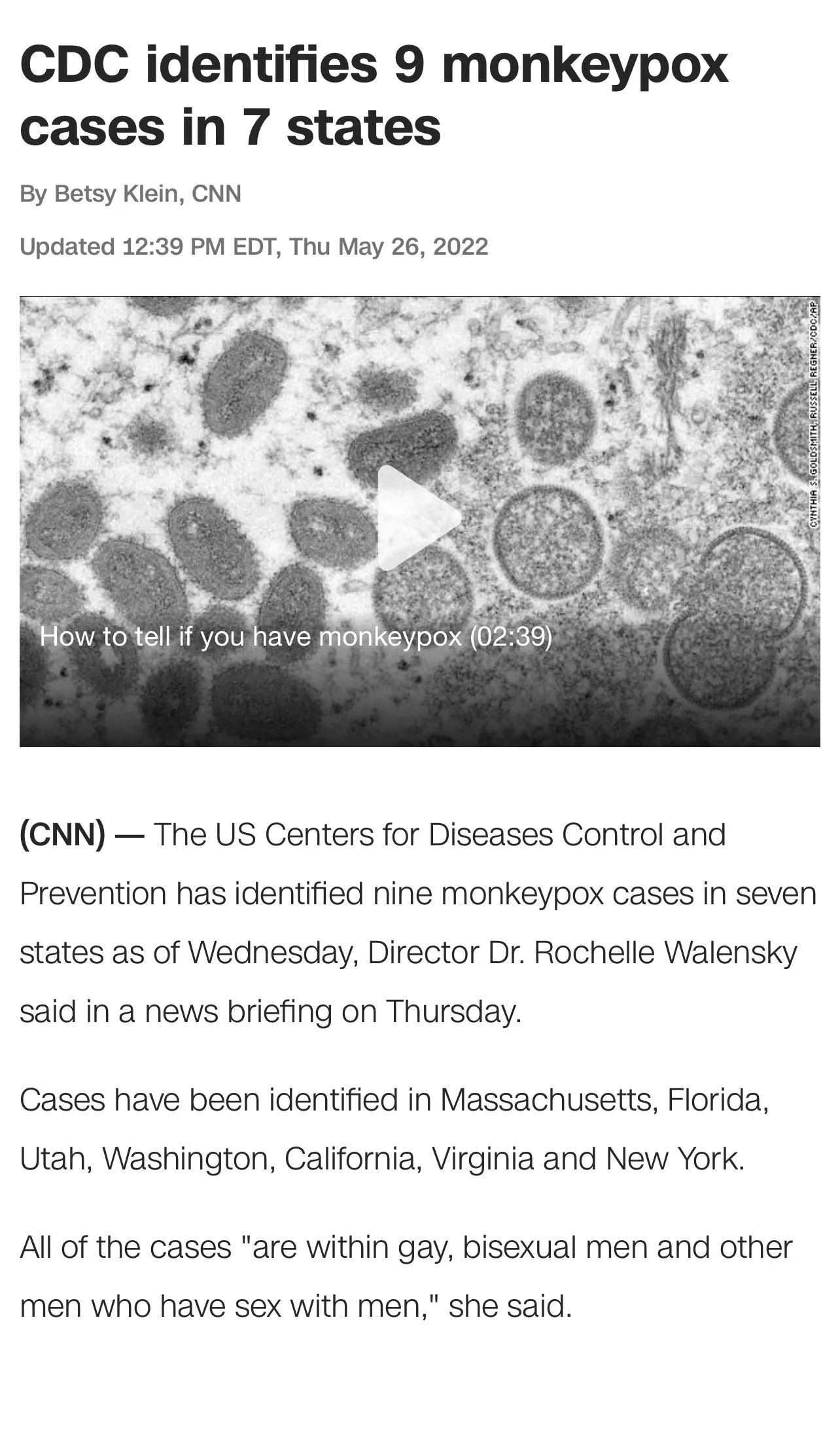 Your fellow slut here telling you to take a break and don’t have sex until this Monkeypox situation gets under control! If I can take a break, so can you! I hate they’re calling it a gay desease already. Be safe boys ❤️
