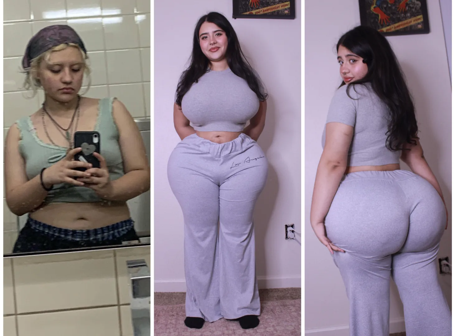 18-19 little over one year difference and 5 surgeries later