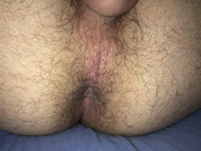 [20] Musked up hole