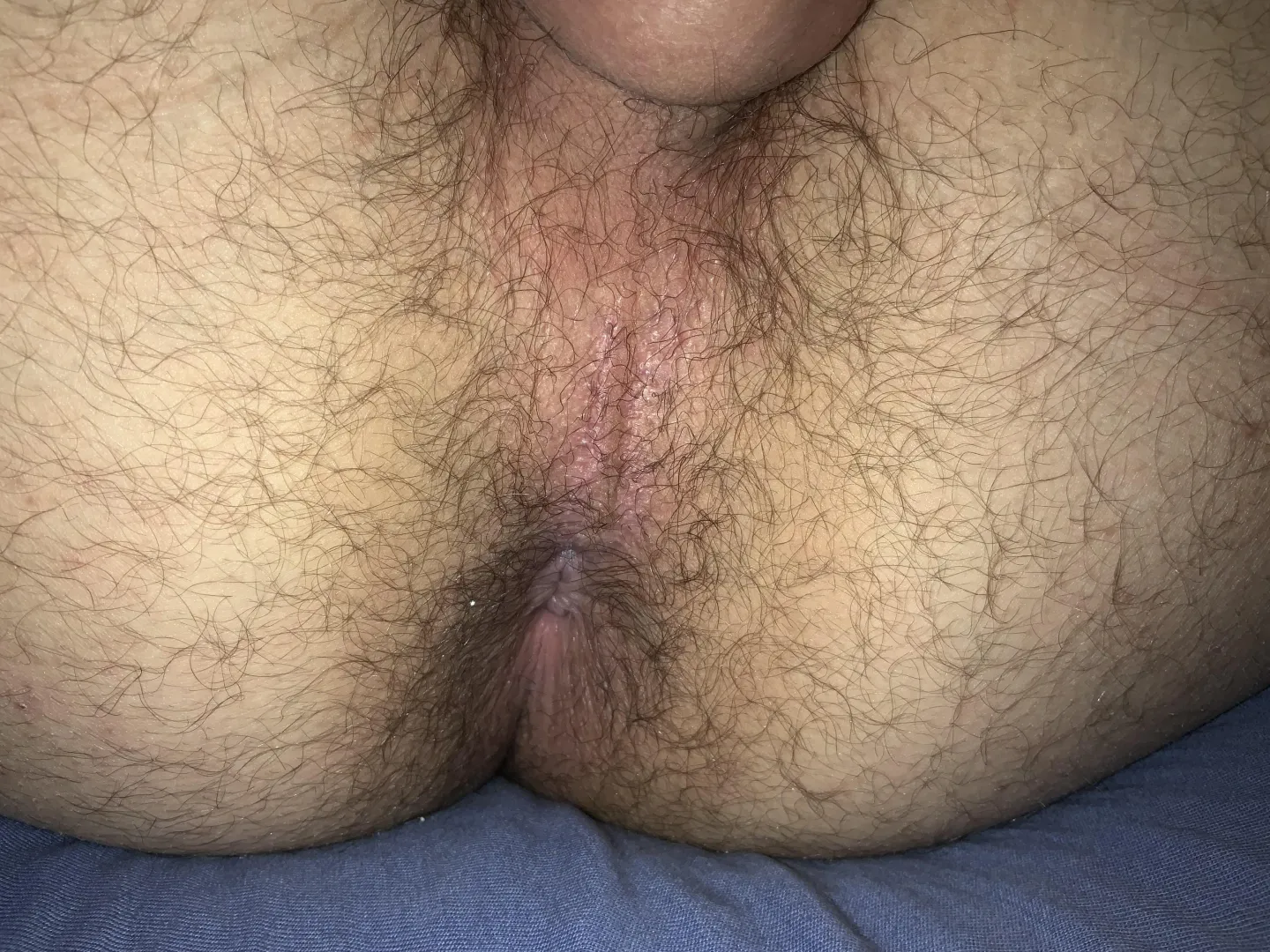 [20] Musked up hole
