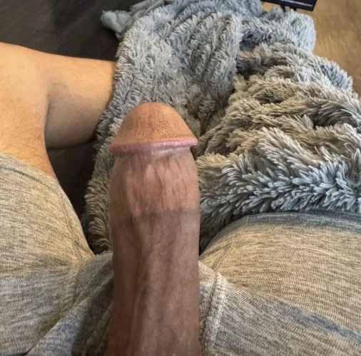 [20] Top4B spring area