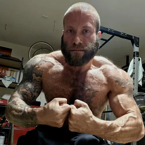 (34M Spina Bifida Para.)