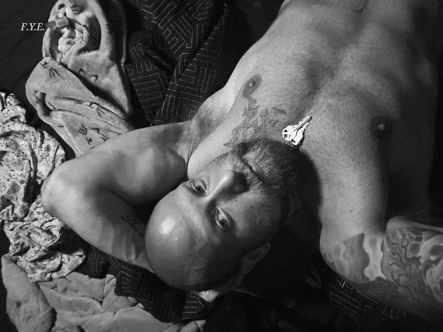 (34m spina bifida para.)