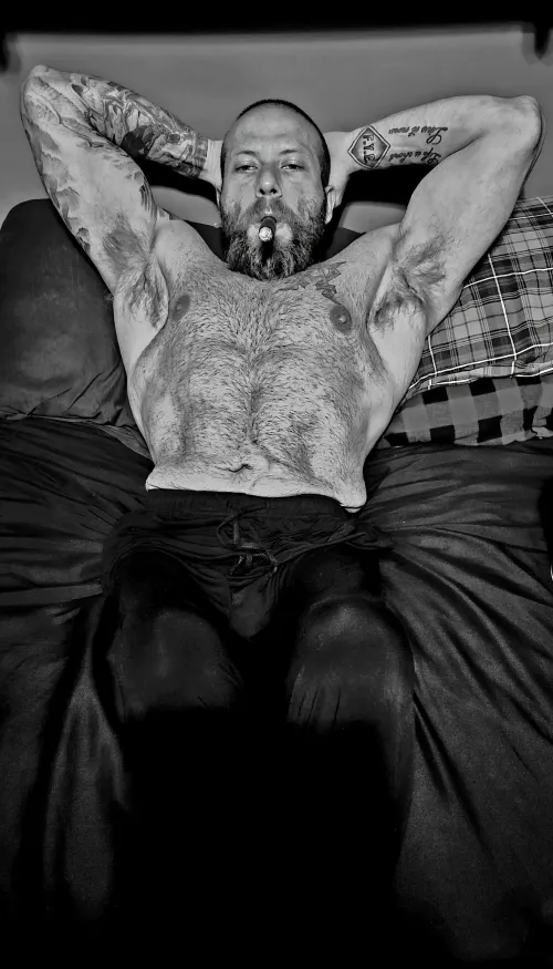 (34M. Spina bifida, para)