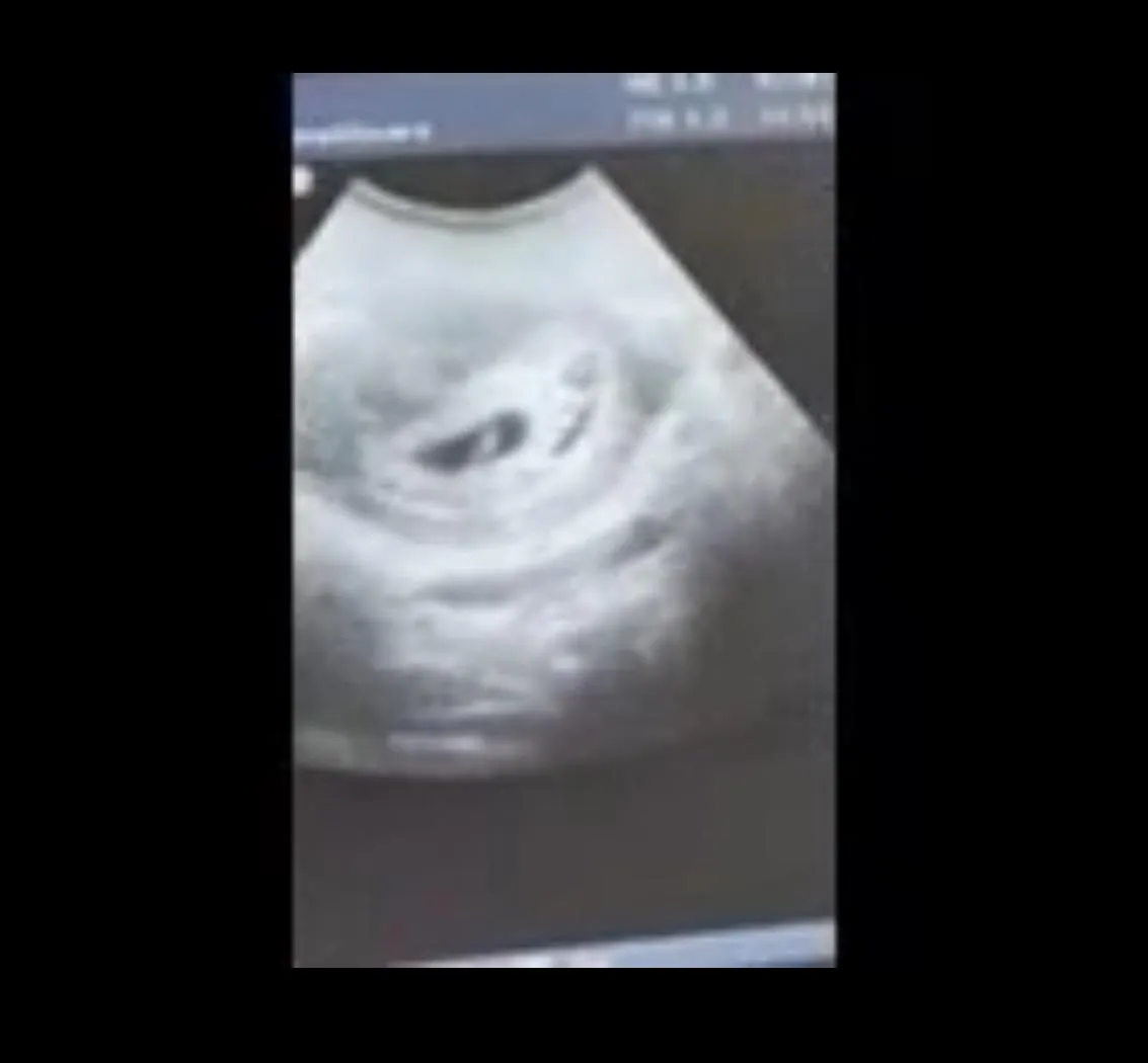 36 [M4F] #Miami 3 times successful breeder