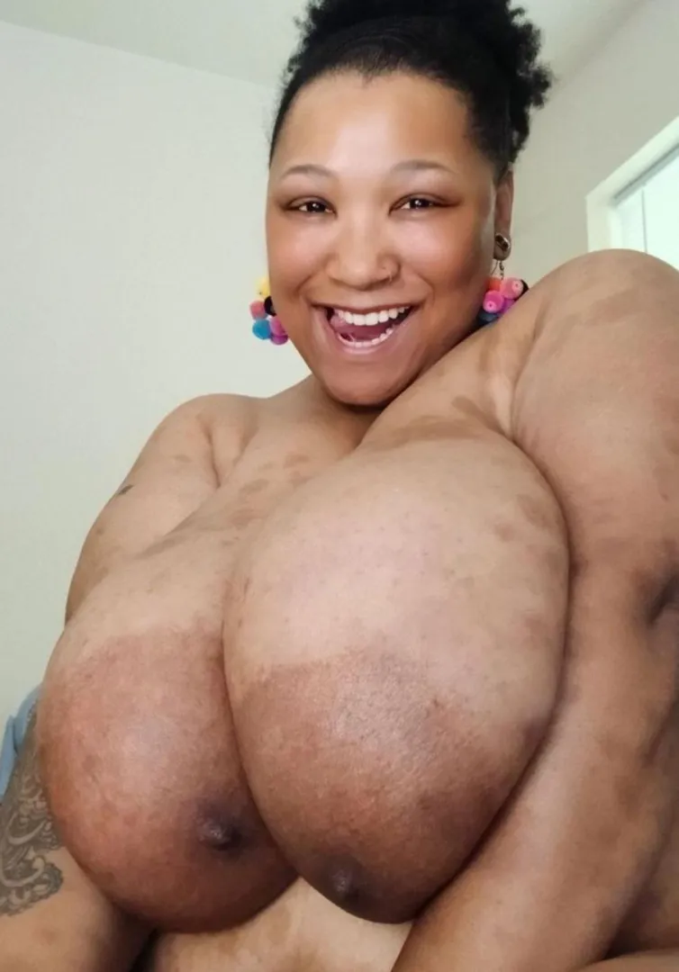 40 year old with mondo melons