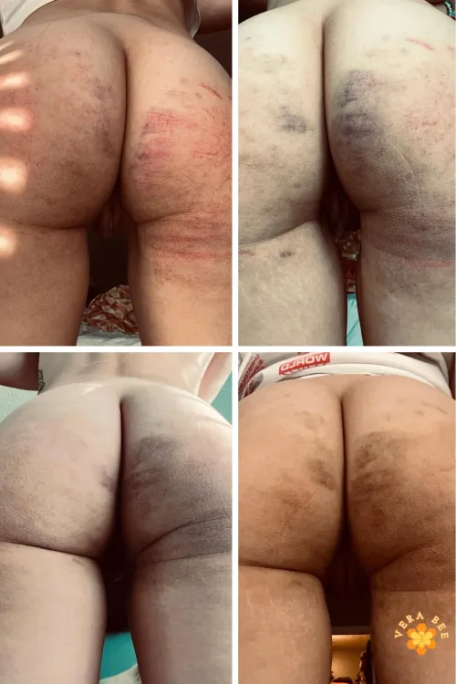 A few days of healing