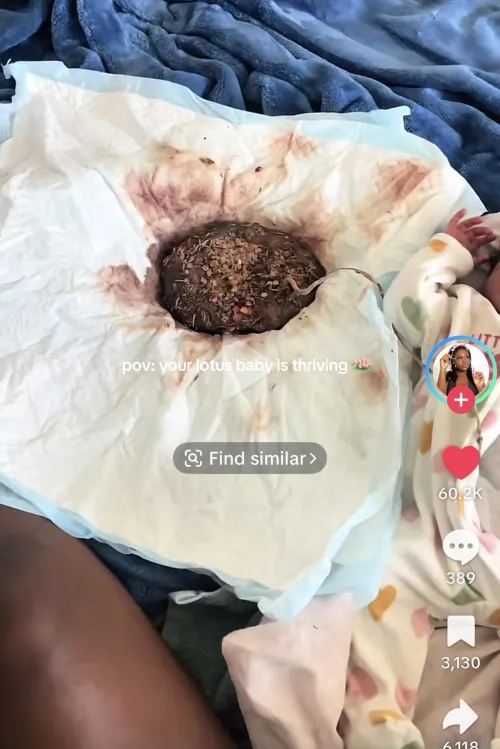 A mom on TikTok decided to not have her babies umbilical cord cut