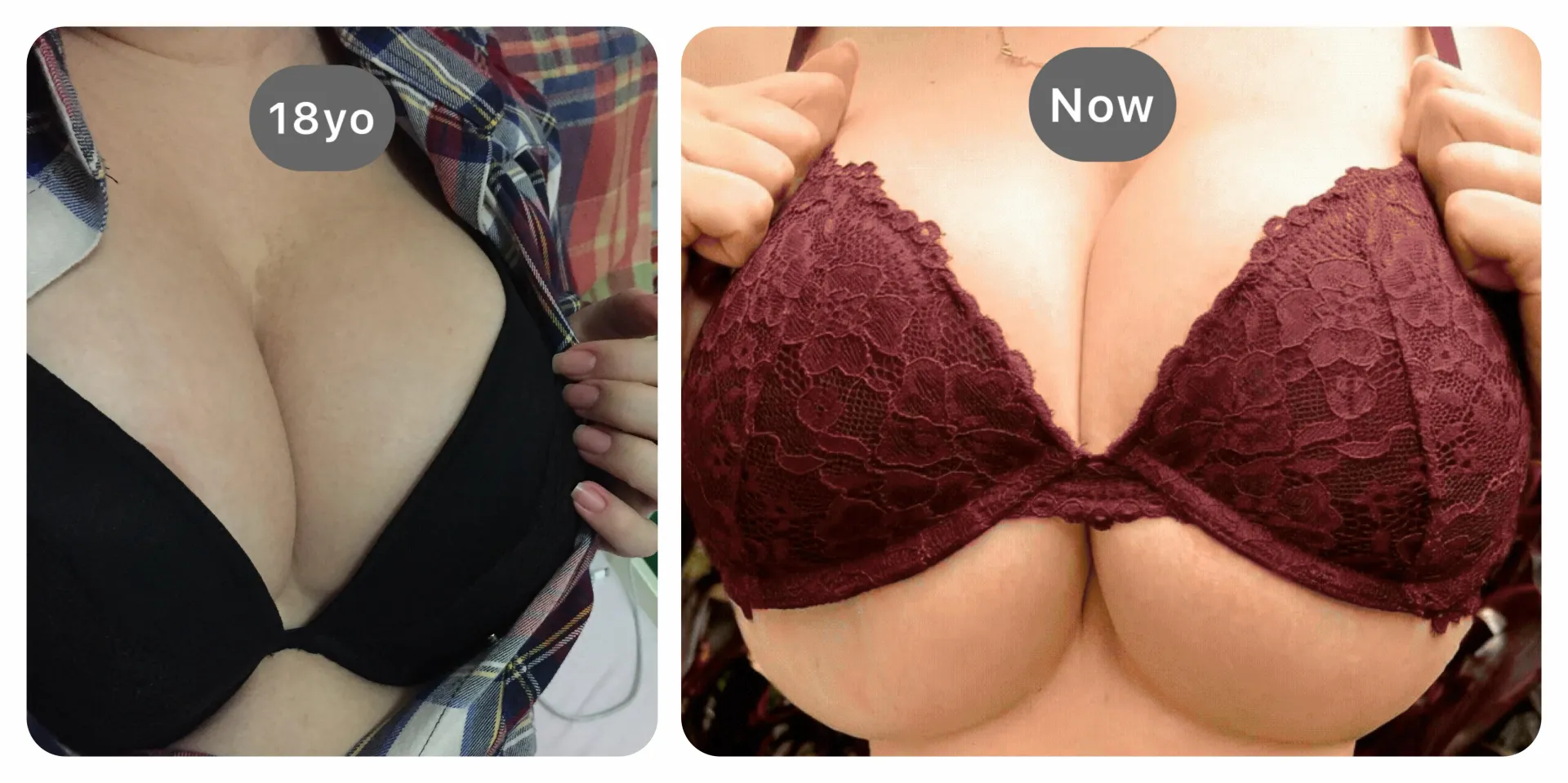 A pic from when they fit a regular bra vs. now