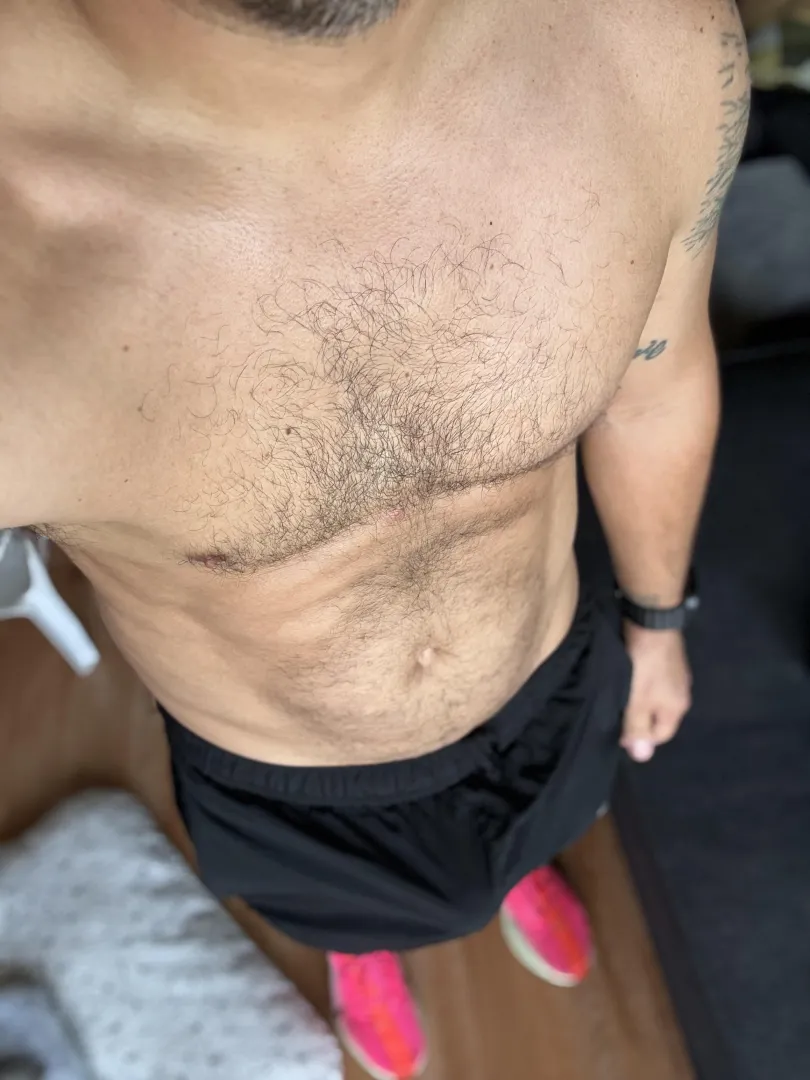 After run endorphins