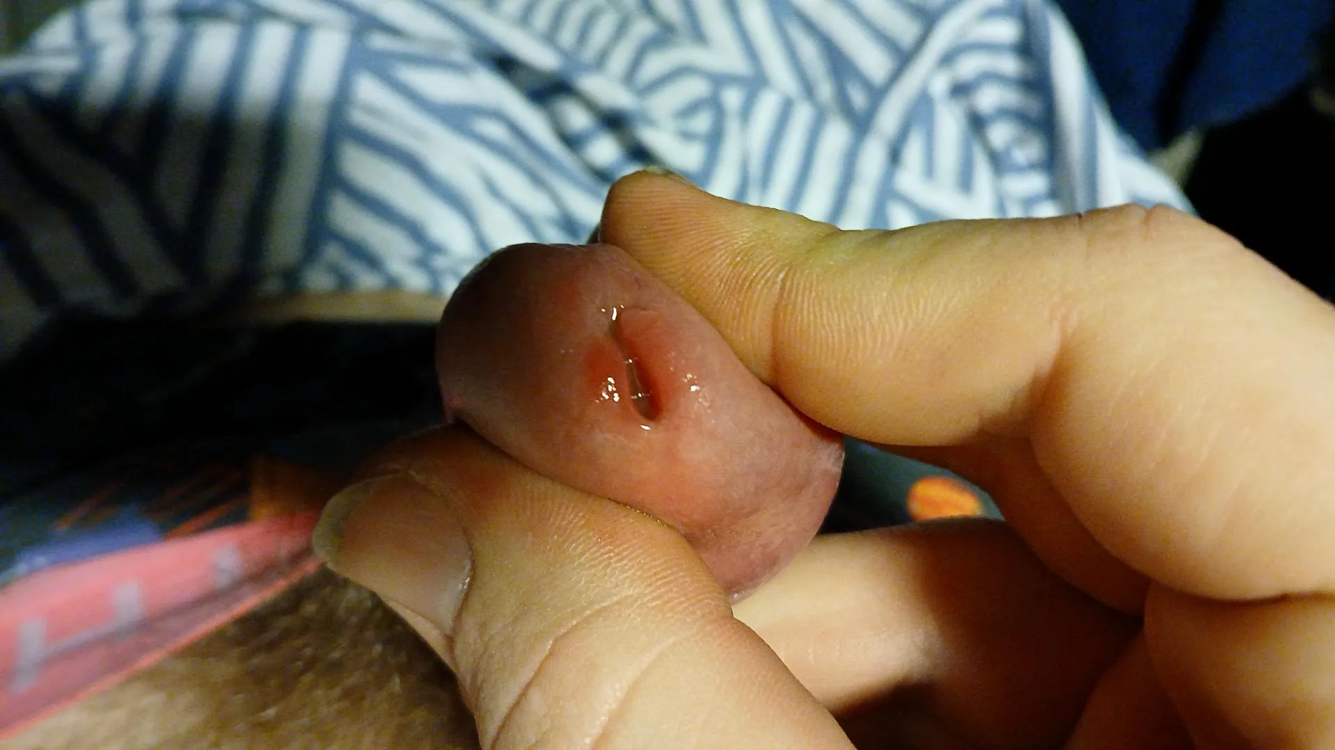 Al little sore one now .... I think al foley its a big no no for now i think also I go up a size if it have heald ...