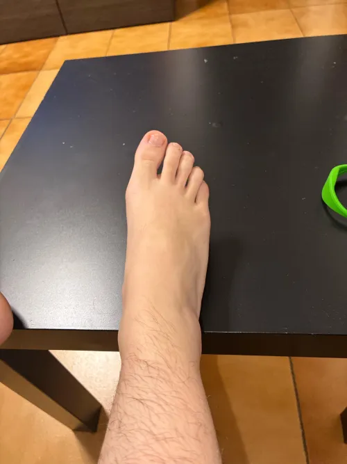 All hairy around here