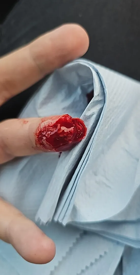 Another angle of the finger tip I posted earlier