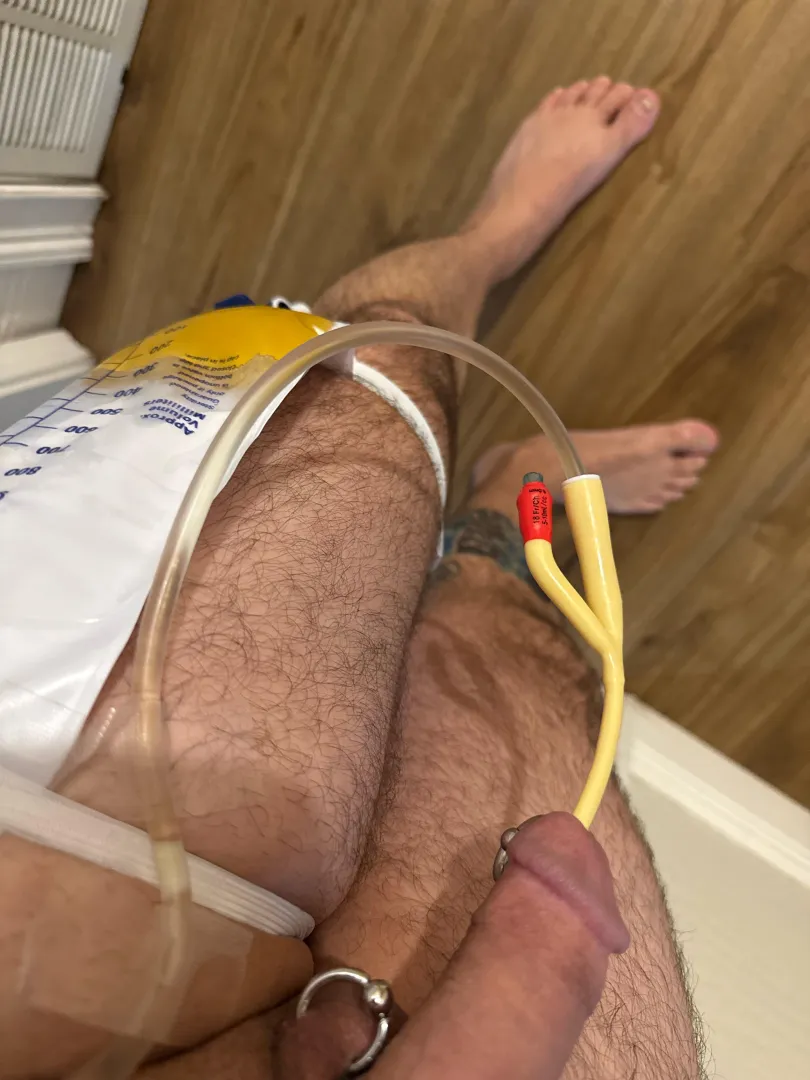 Another successful 18f!