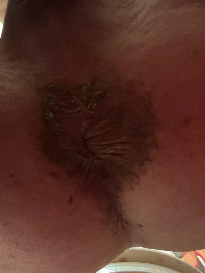 Anyone Have a Tongue I Can Barrow?