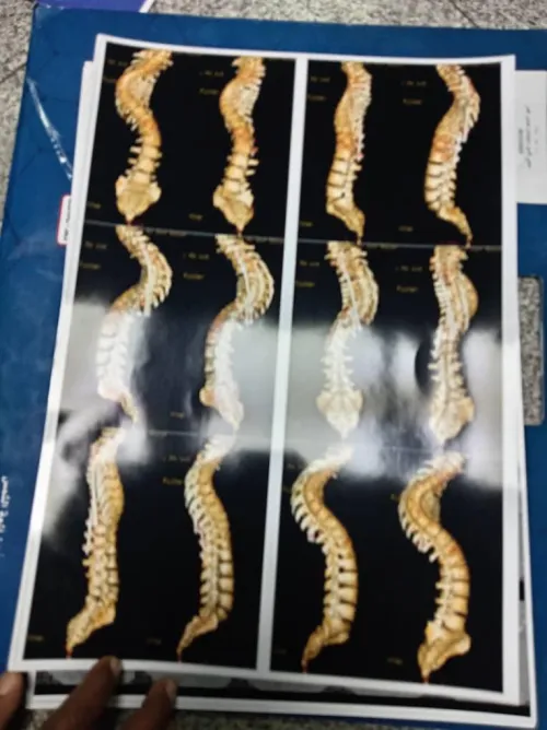 Anyone near Parkville... BBC here