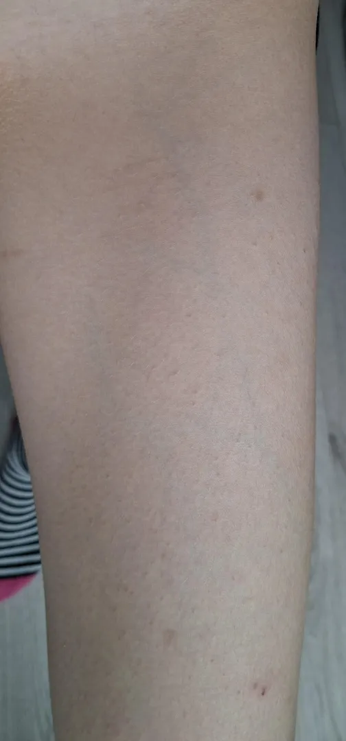 are more visable veins and legs feeling numb reason to be concerned?