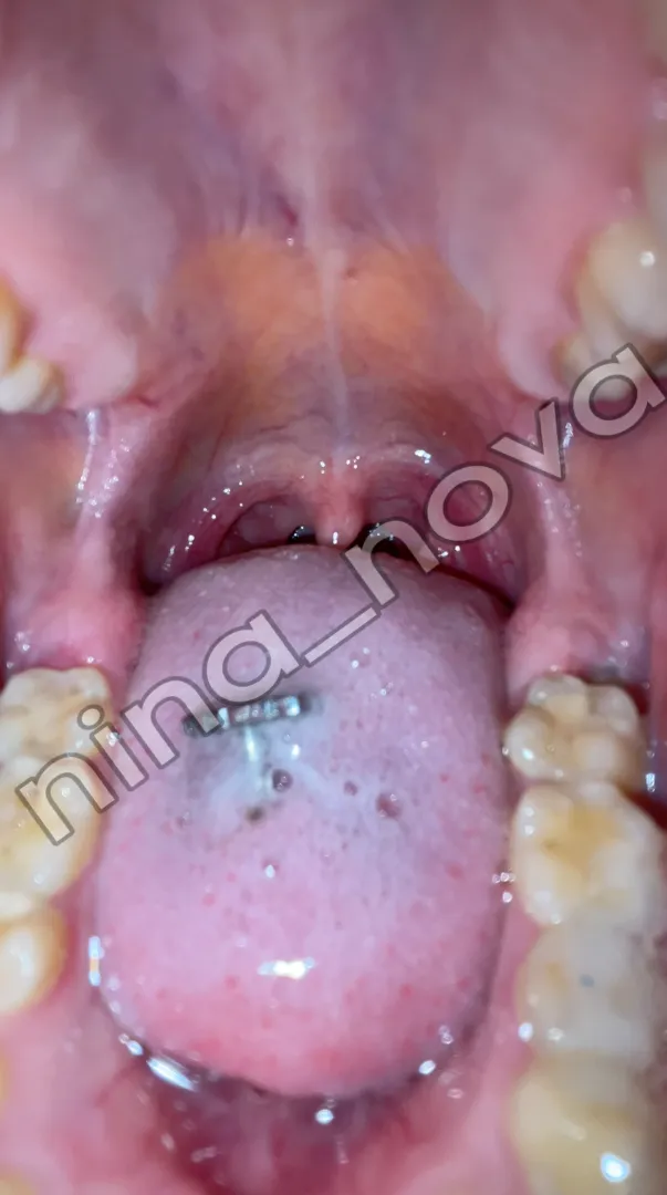 Beatiful, isn't it? That's gonna be your last view {f}