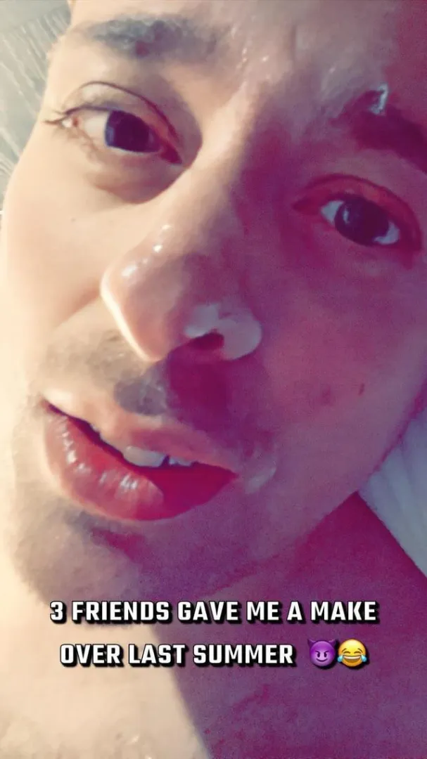 Because of bad behavior, I got my face ruined