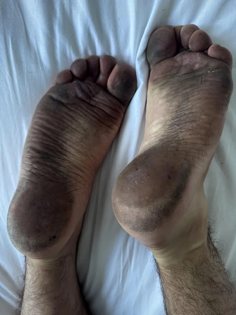 been a while since i went barefoot 