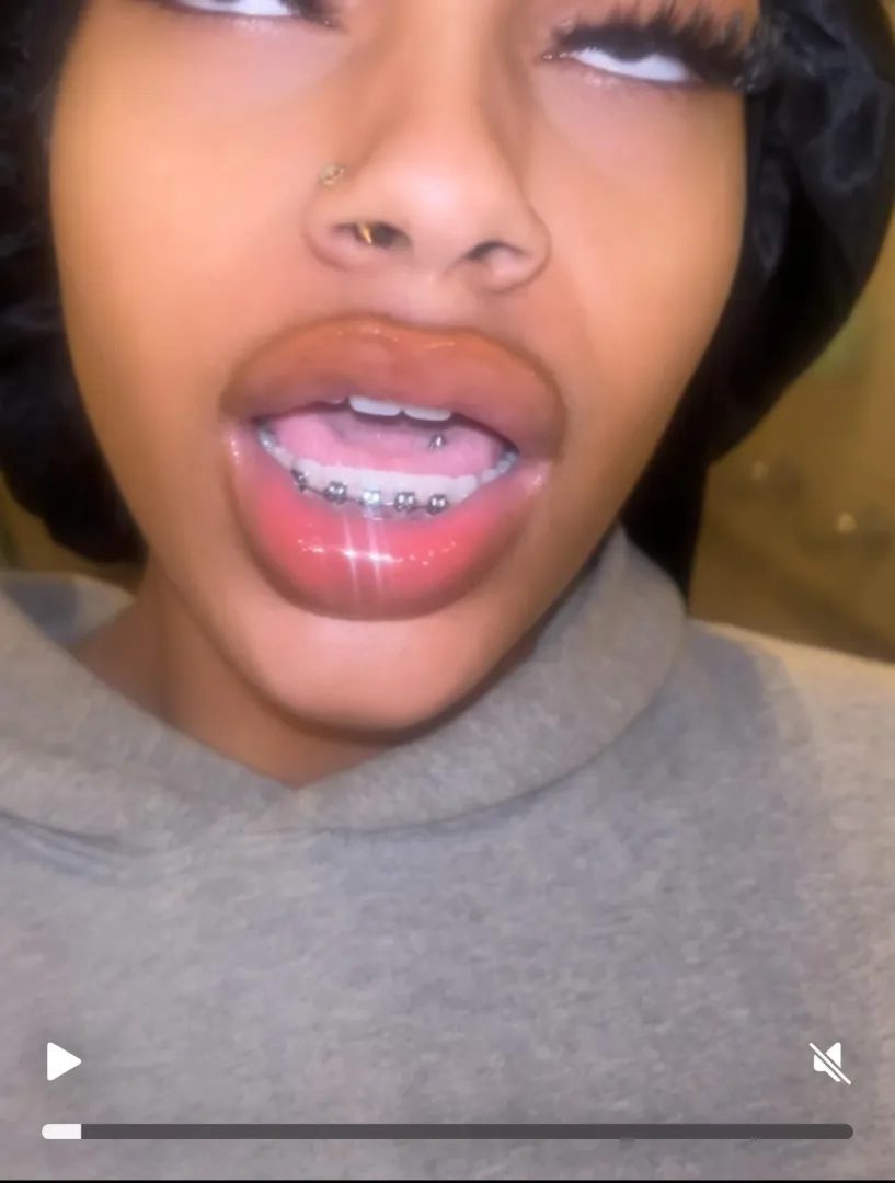 Best combo, braces and a tongue piercing