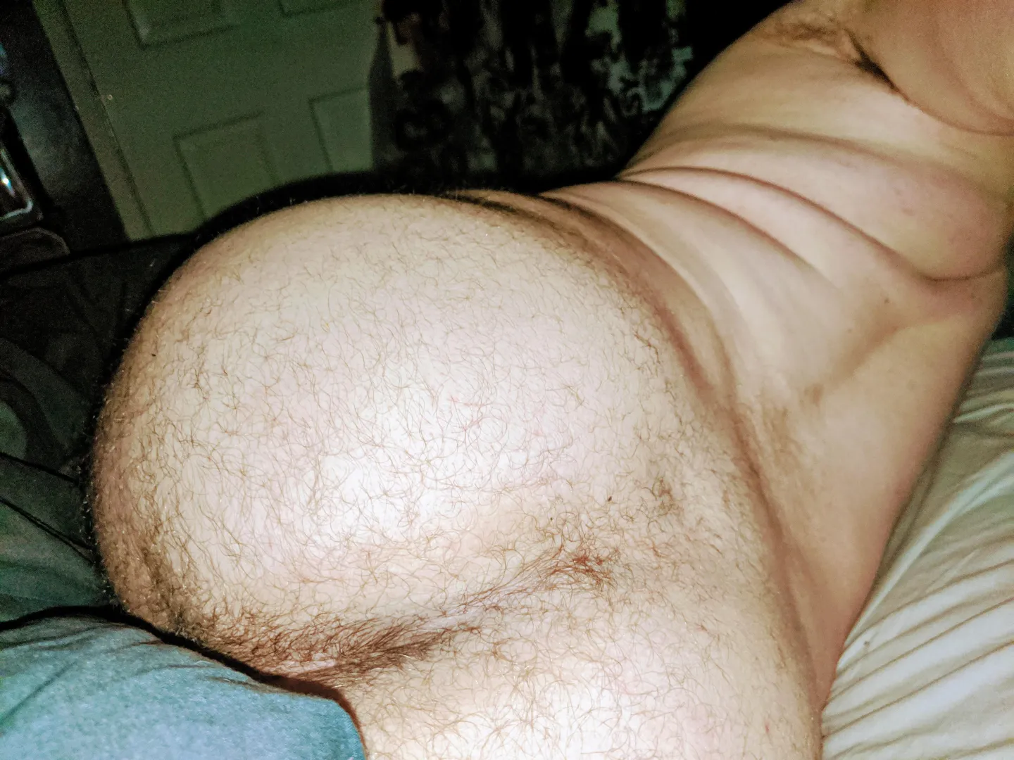 Bottom Guisbrough - No above 38