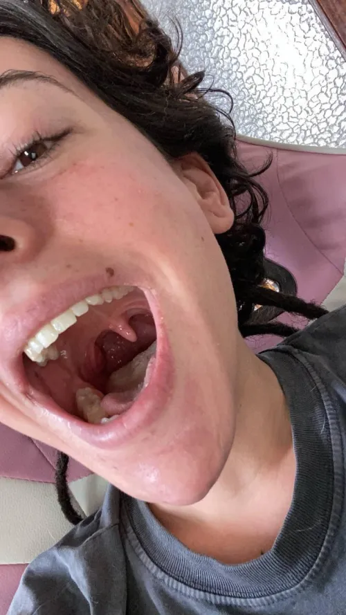 CUSTOMS OPEN. I’m back with some #uvula. Beautiful huh? tl: rgsar03