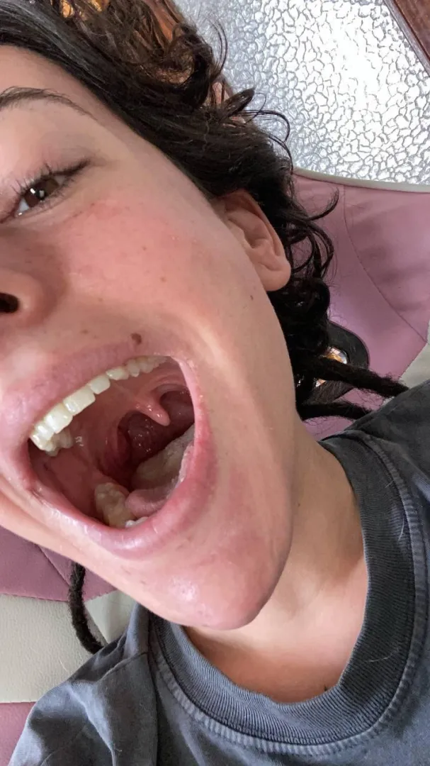 CUSTOMS OPEN. I’m back with some #uvula. Beautiful huh? tl: rgsar03