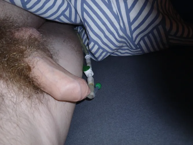 Do you also get horny when you have a catheter in you? I notice that I am getting hornier and hornier, grrr, but I will see how I solve that because I will probably have to have a catheter permanently. There is a 5 percent given by the urologist that I c