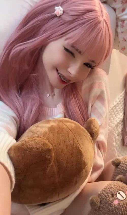 Do you like my braces?