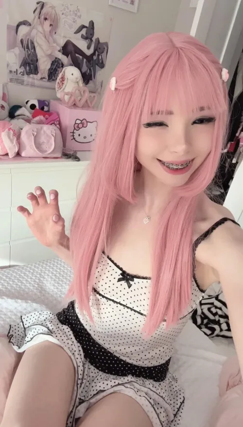 Do you like my braces?