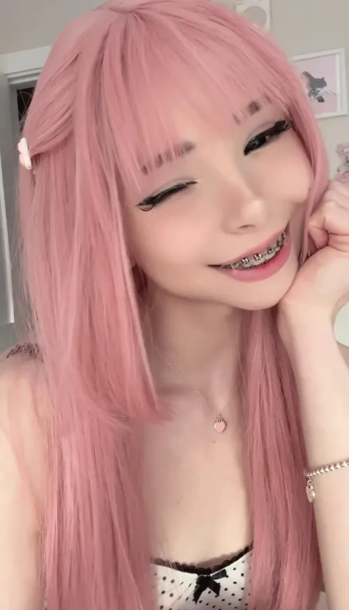 Do you like my braces