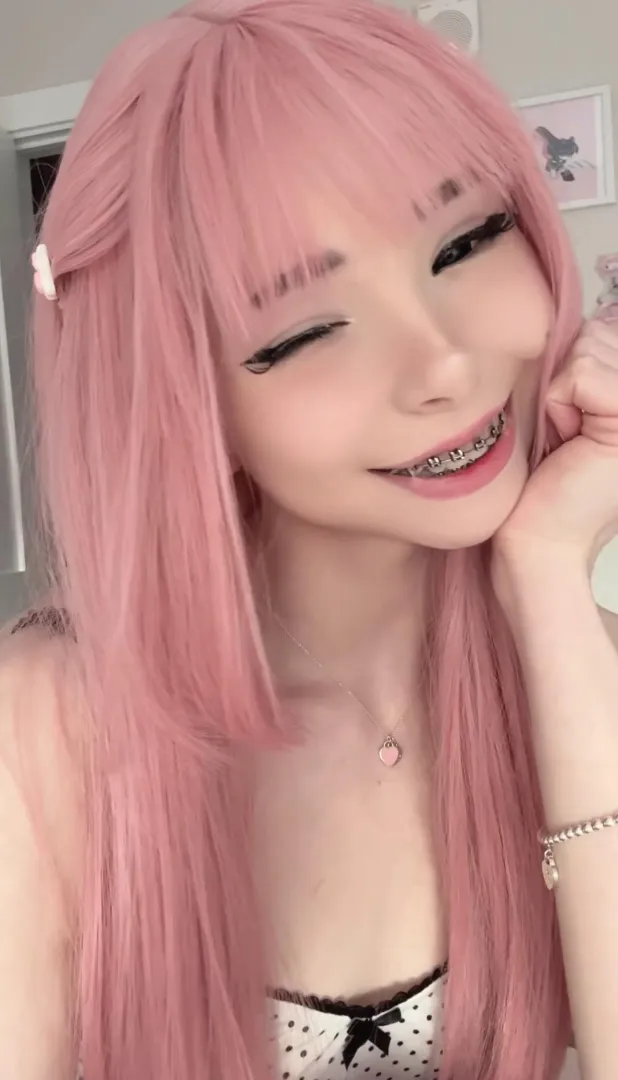 Do you like my braces