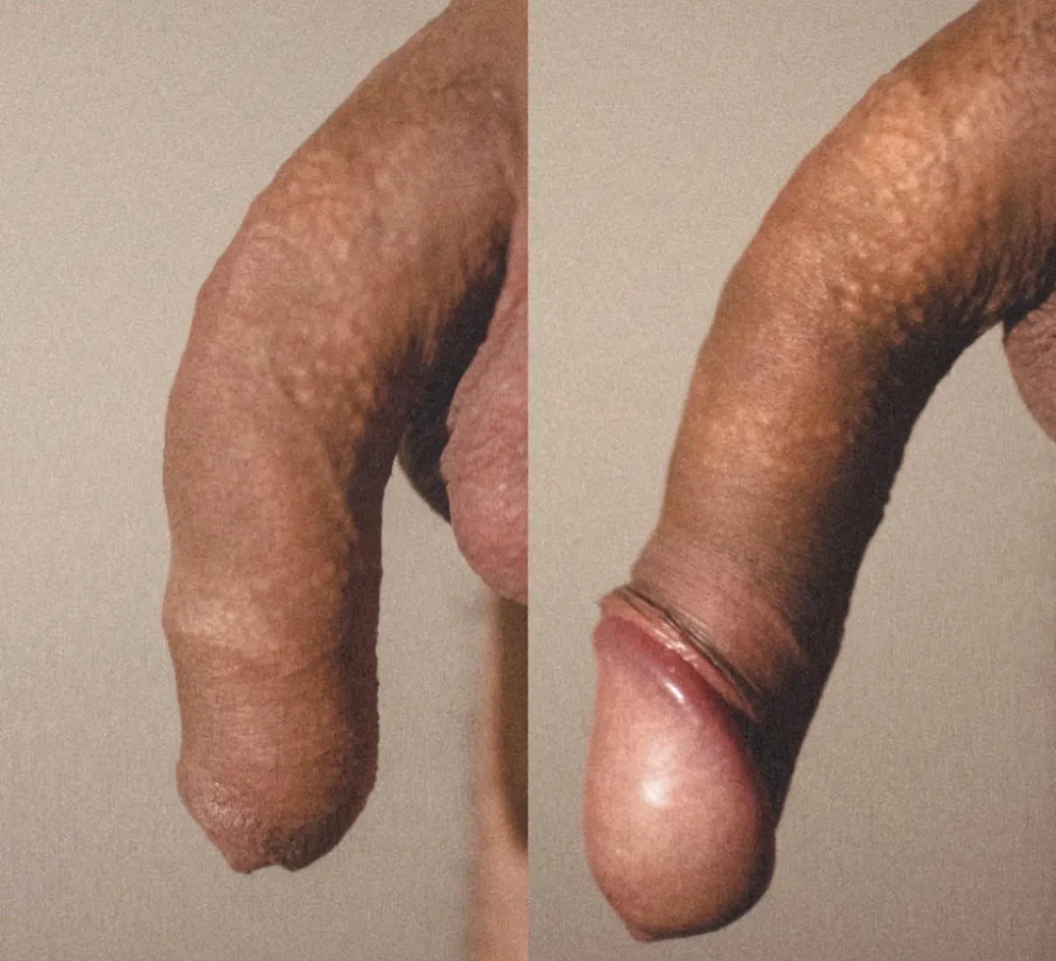 Do you prefer it covered or uncovered?