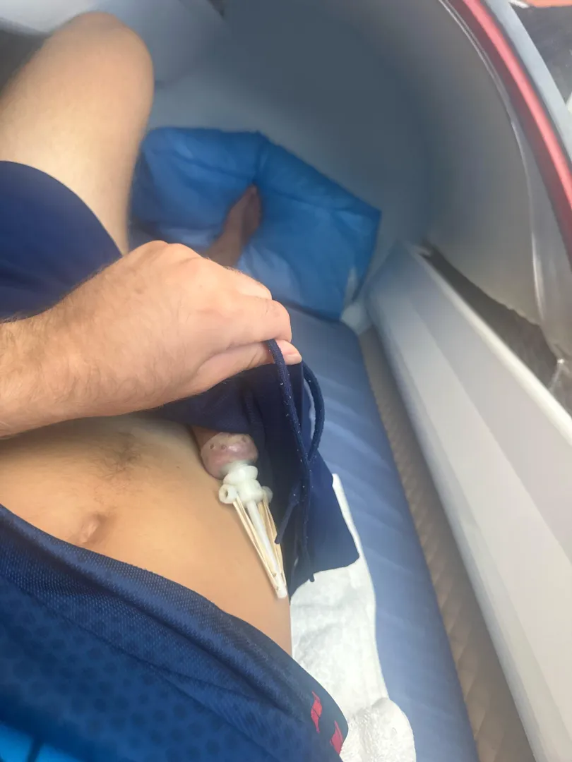 Dual Tension restorer + question