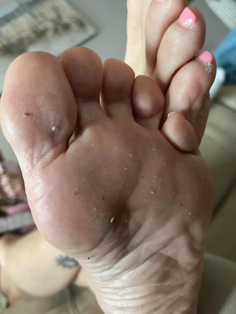 Dust and debris on my feet