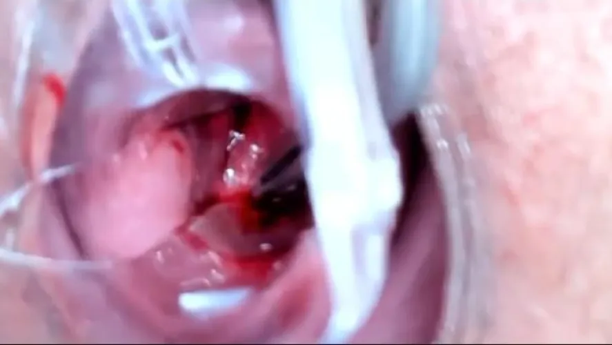 Extreme Cervix Community 