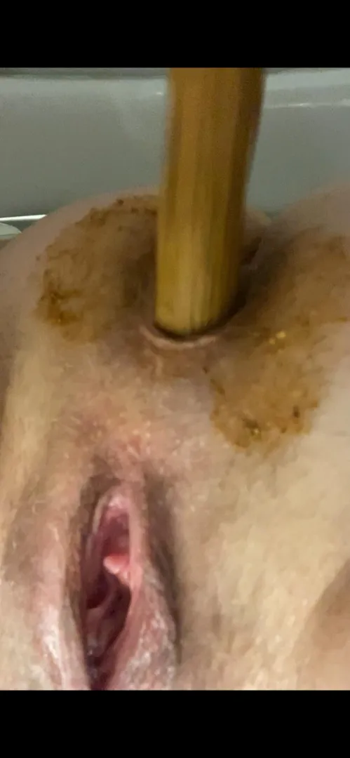 [F] I post daily 