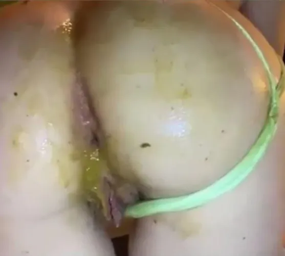 [F] scat playing content, Dropbox