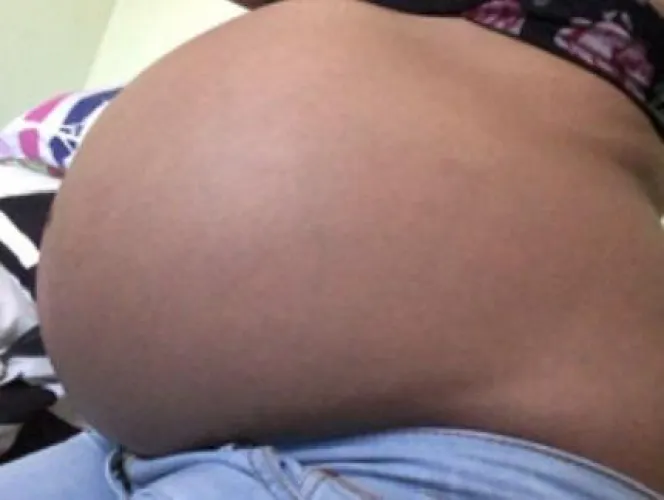 Feeders can you burst my belly .,?