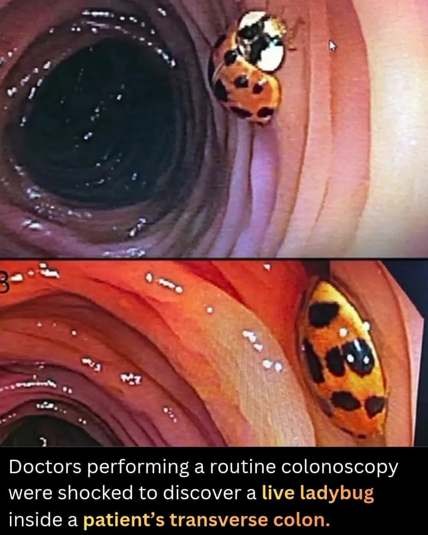 First Known Photograph of Adam