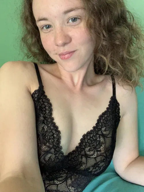 Freckles are natural and beautiful