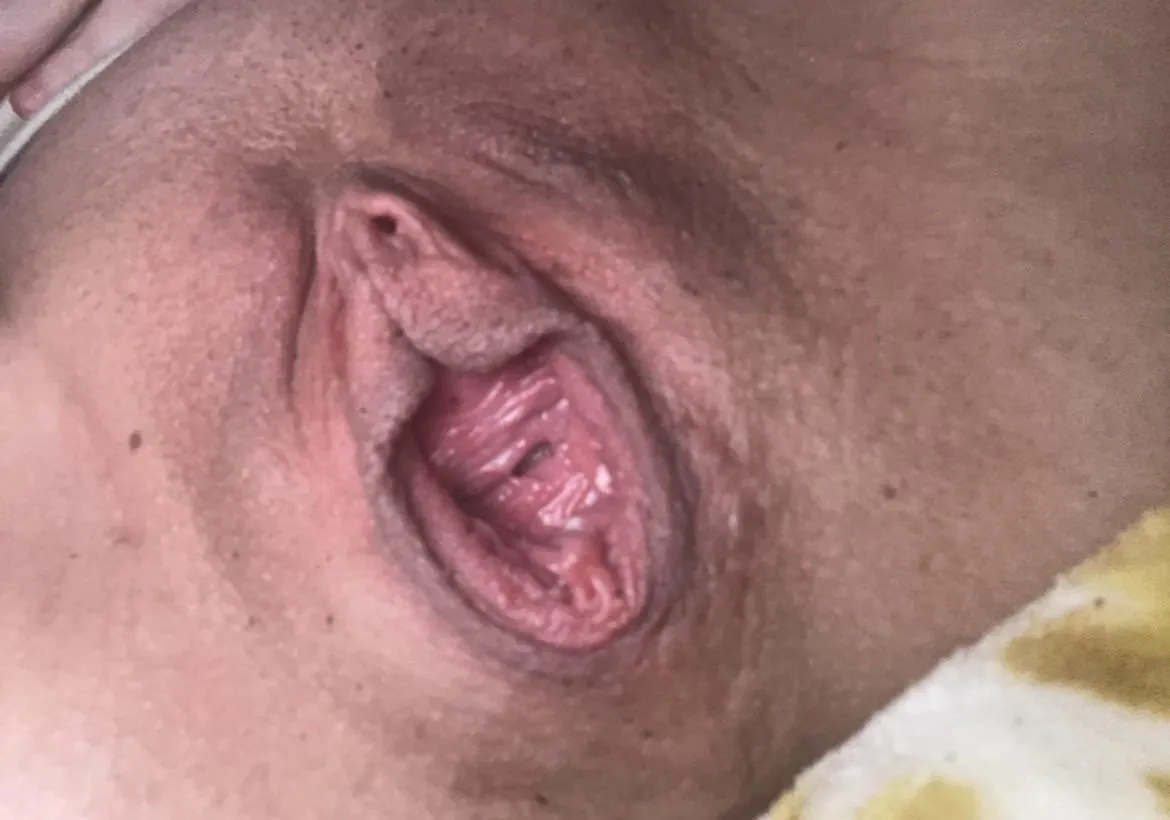 Gape update ️