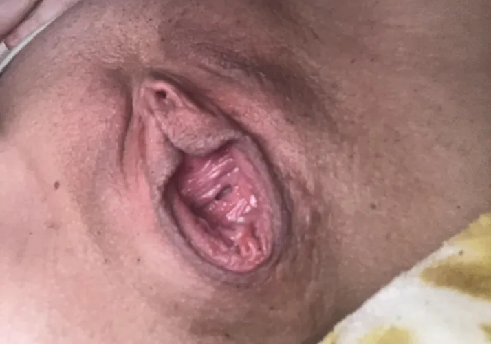 Gape update ️