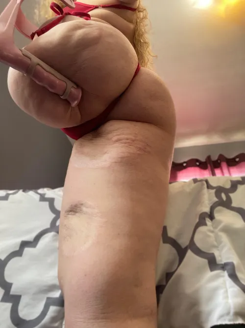 Good morning from your favorite HAG (Hip Amputee Goddess). May your day be finer than my ass